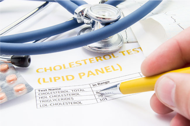 General practitioner checks cholesterol levels in patient test results on blood lipids. Statin pills, stethoscope, cholesterol test and hand of doctor